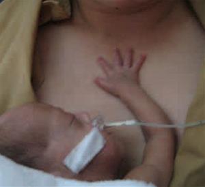 Bebé prematuro con su madre