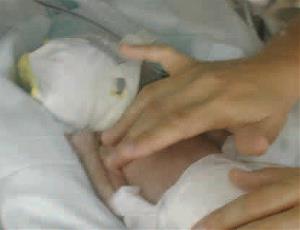 Atención a un bebé prematuro