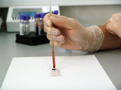Muestra de sangre en un laboratorio